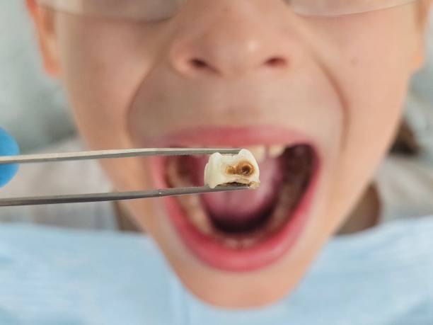 Best Emergency Dentist for Special Needs Patients in Summit, IL