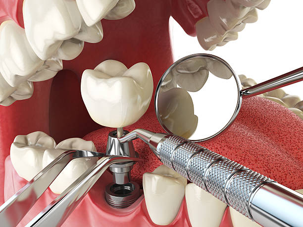 Best Pediatric Emergency Dentist in Summit, IL